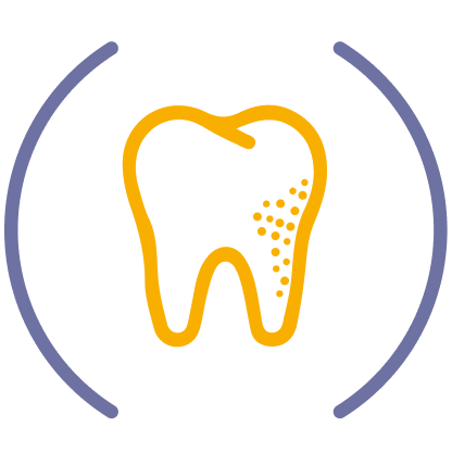 Periodontitis, una infección grave de las encías que puede provocar la pérdida de los dientes.