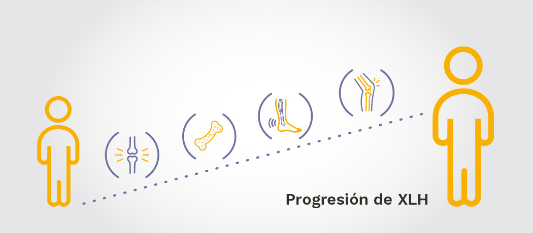 Gráfico que muestra los signos de progresión de XLH a lo largo de la vida